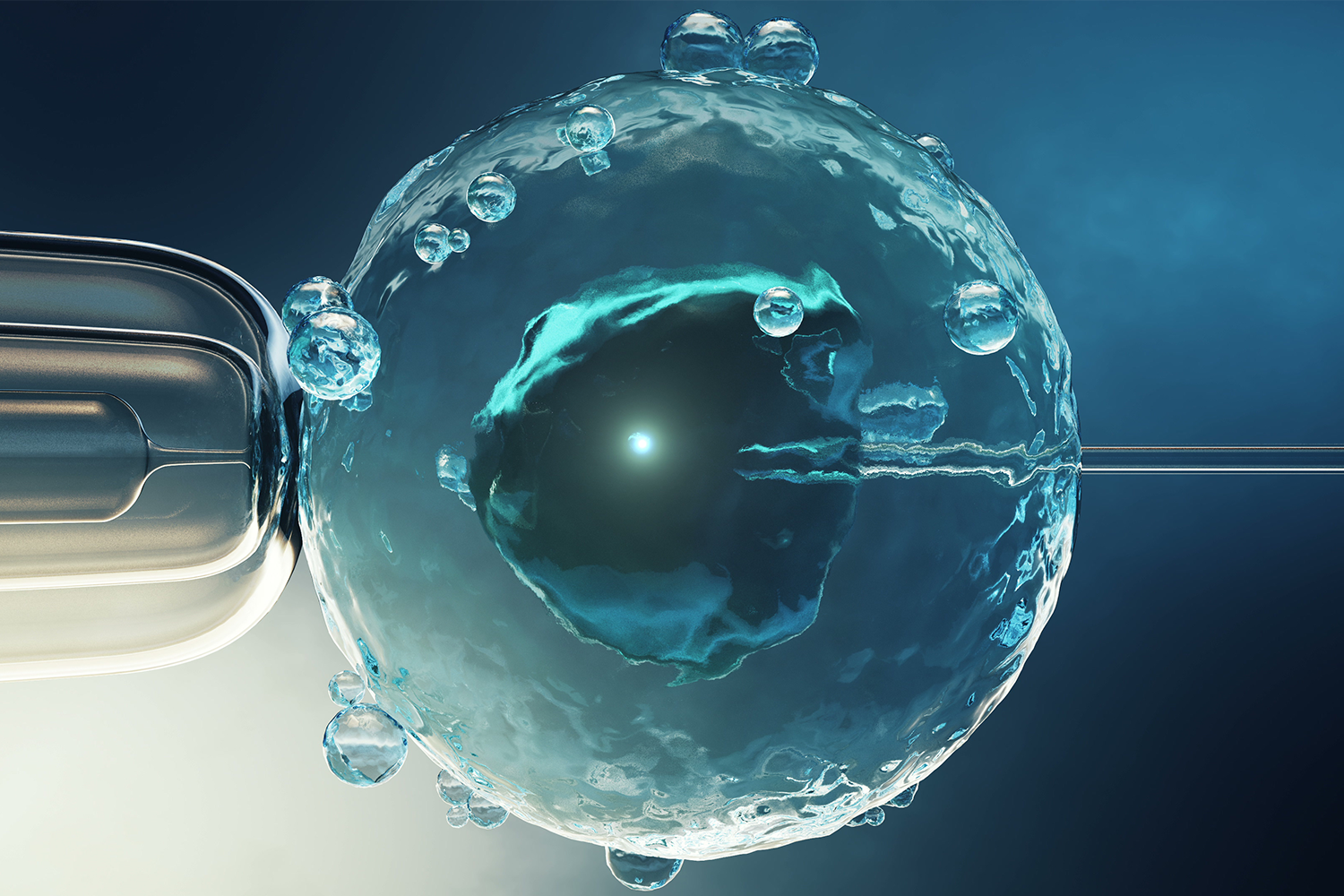 Laser assisted hatching